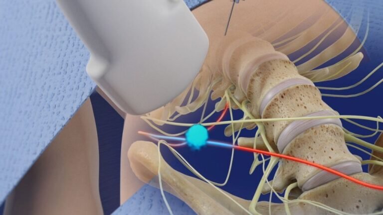 Peripheral Nerve Blocks Anaesthesia - anaesthesianotes