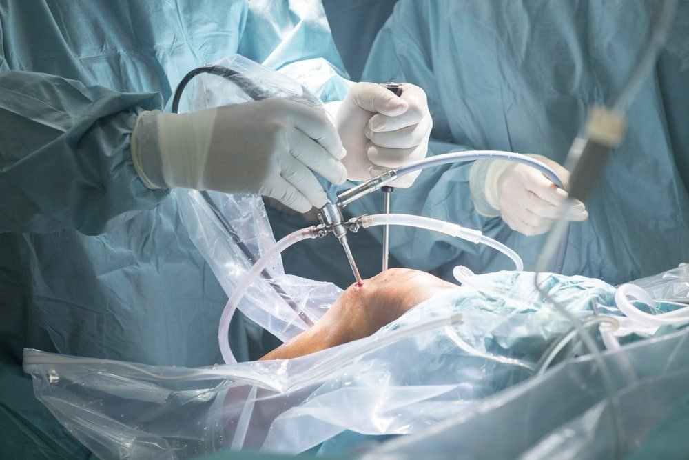Orthopedic Anaesthesia Training Program